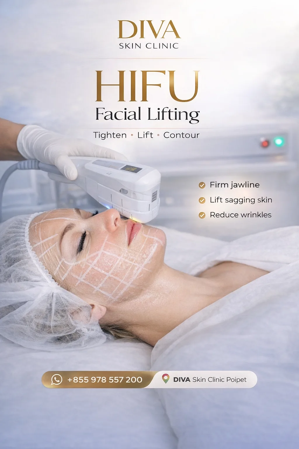 HIFU lifting technology at DIVA Skin Clinic Poipet